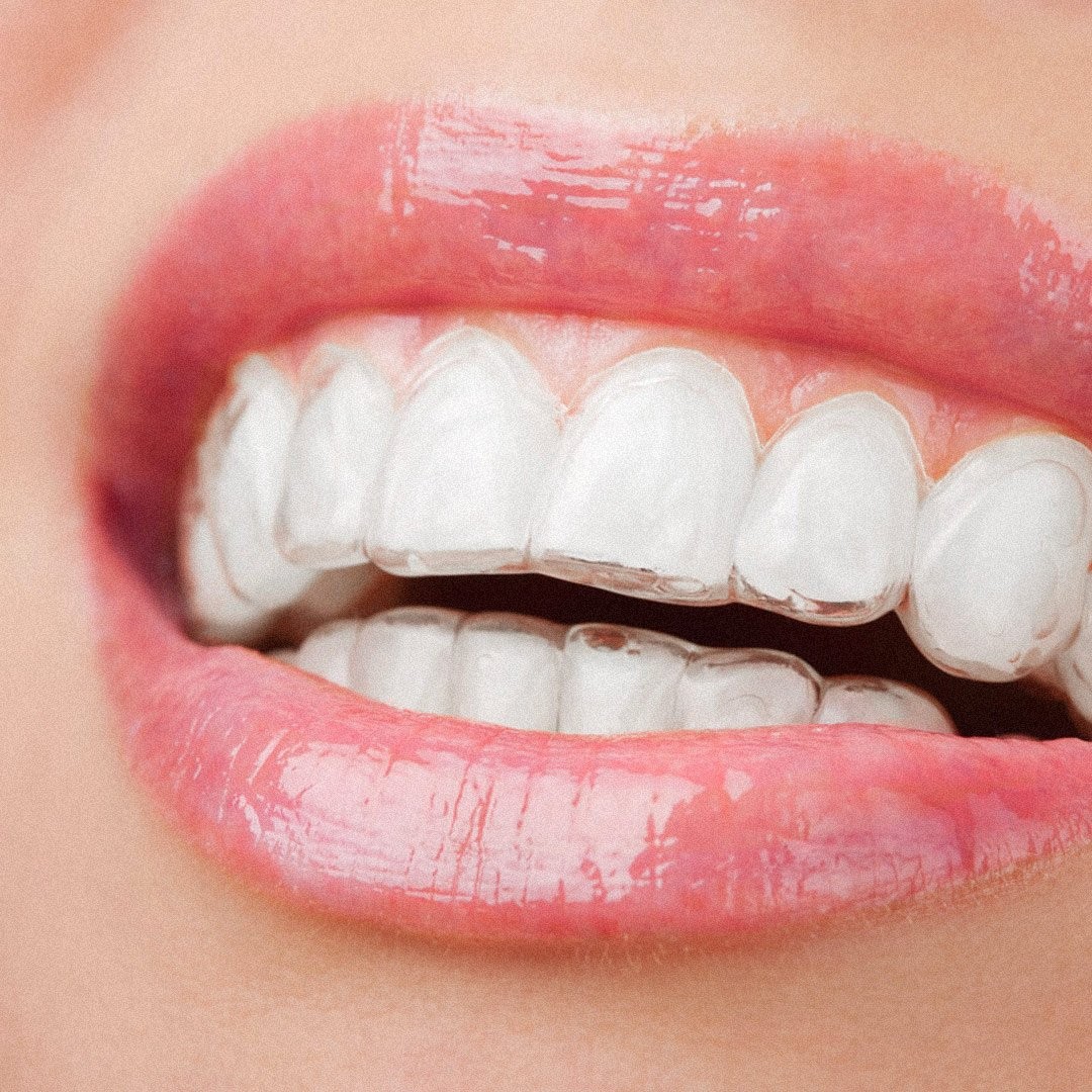 Flotte og regelmæssige tænder med Invisalign